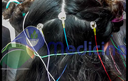 En contraste contra un electroencefalograma normal, cuando hay crisis o epiilepsia el registro eléctrico cambia de forma sutil hasta drástica. 